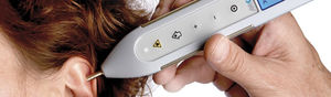 laser para acupuntura