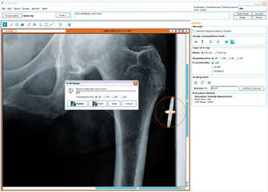 software para cirurgia da anca