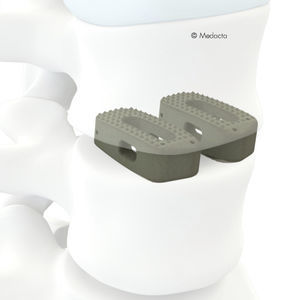 espaçador intervertebral toracolombossacral