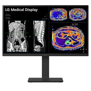 monitor médico