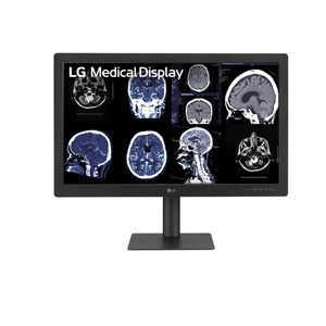 monitor médico