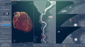 módulo de software de cardiologia