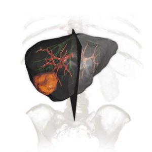 módulo de software para radiologia
