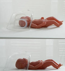 capacete de oxigenação neonatal