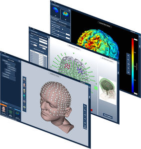 software de neuroestimulação