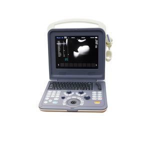 aparelho de ultrassom portátil 1