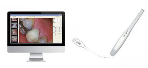 câmera intraoral