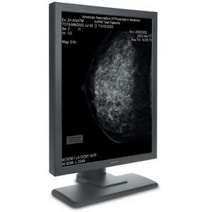 monitor para mamografia