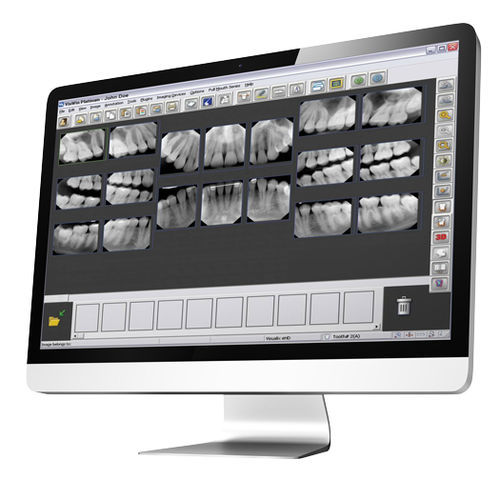 Software de gestão - Gendex™ VixWin™ Platinum - DEXIS - de visualização / médico-hospitalar / odontológico