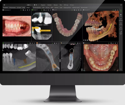 Software clínico - DTX™ Studio - DEXIS - odontológico / para imagiologia dentária / de gestão