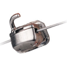 Tubo ortodôntico vestibular molar - SnapLink™ - Ormco - conversível