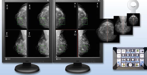Módulo de software de visualização - aycan Medical Systems - de gestão de dados / para mamografia
