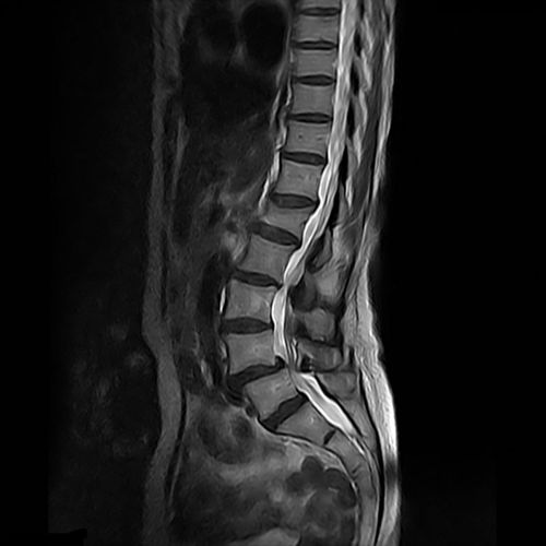 Software de visualização - GOPView MRI2Plus - ContextVision - para RM