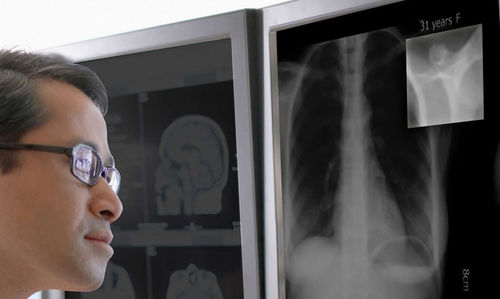 Software de diagnóstico - CFS™ - Double Black Imaging - de monitorização / de calibração / para telas médicas
