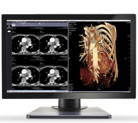 Monitor médico - GEMINI-4MP - Double Black Imaging - 30" / LED / DVI