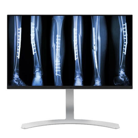 Monitor médico - CL8MPS - Double Black Imaging - de diagnóstico / 3840 x 2160 / 27"