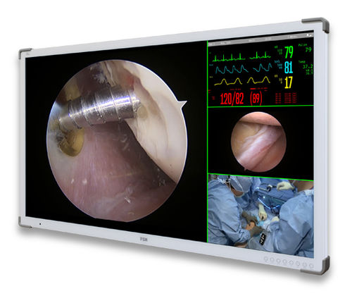 Monitor médico - C55SF - Double Black Imaging - cirúrgico / Full HD / 3840 x 2160