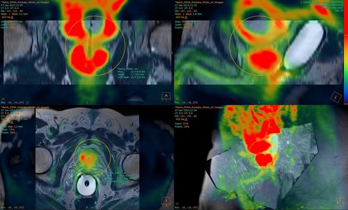 Software clínico - Fusion Technology™ - Hermes Medical Solutions, Inc - para TC / PET / SPECT