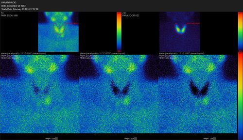 Software visualizador - Hermes Medical Solutions, Inc - para quantificação / SPECT / de sistema endócrino