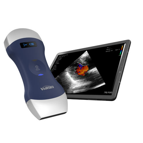 Aparelho de ultrassom de bolso - Shenzhen Viatom Technology Co., Ltd. - geral / em preto e branco / com Doppler colorido