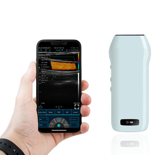 Aparelho de ultrassom de bolso - C10cx - Shenzhen Viatom Technology Co., Ltd. - geral / urológico / da mama