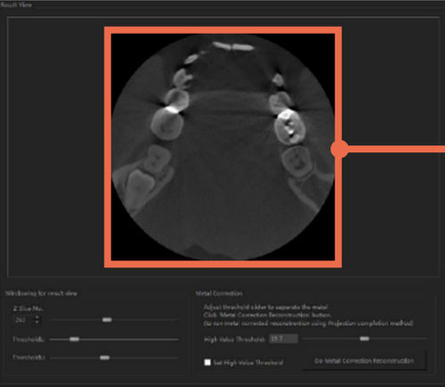 Software de análise de imagens - DentiqRecon - 3D Industrial Imaging, Co., Ltd. - médico-hospitalar / para TC