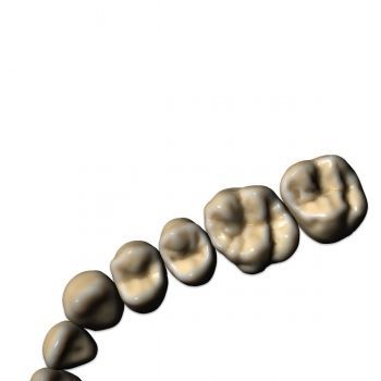 Módulo de software CAD - ZRS - Champions Implants GmbH - para implantodontia / de dentes