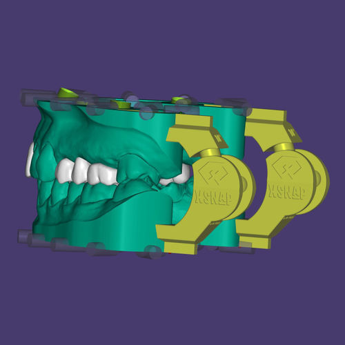 Módulo de software para implantodontia - xSNAP® - Champions Implants GmbH - de modelagem
