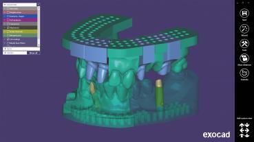 Módulo de software de design - Model Creator - Champions Implants GmbH - de fabricação / de modelagem / de captura