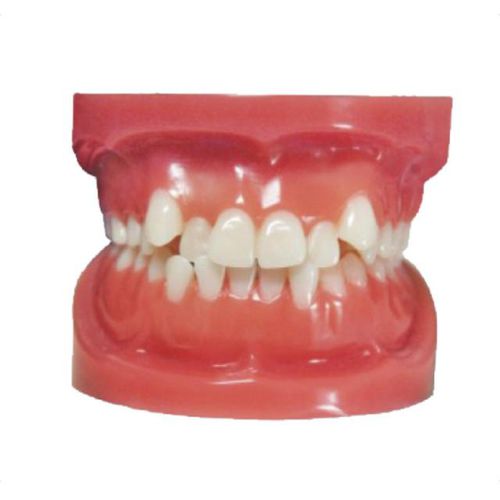 Typodont de dentição - Angle Class I - Creative Dental - para procedimentos odontológicos