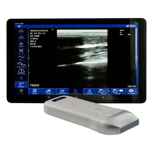 Aparelho de ultrassom de bolso - WU9 series - Garda Laser - geral / em preto e branco / com transdutor "tudo-em-um"