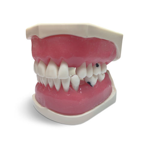 Modelo de gengiva - E56 - GF DENTAL - de dentição / para procedimentos odontológicos / para ensino