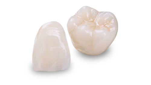 Material dentário em cerâmica - Obsidian®  - Glidewell Europe - para pontes dentárias / para coroas dentárias / para inlays dentários