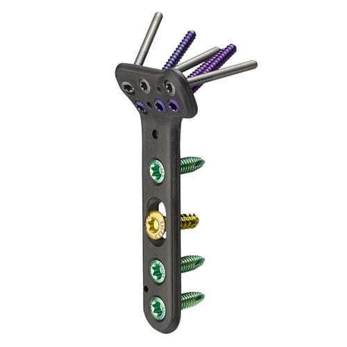 Placa de compressão óssea para rádio - CarboFix Orthopedics - distal / bloqueada / não bloqueada