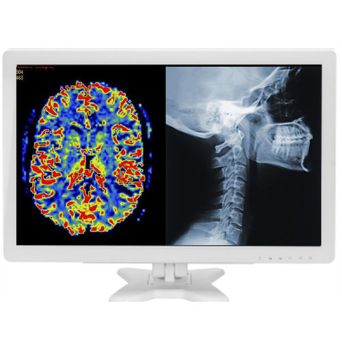 Monitor médico - MMS-27C-R10 - BriteMED Technology - cirúrgico / para endoscopia / de laparoscopia