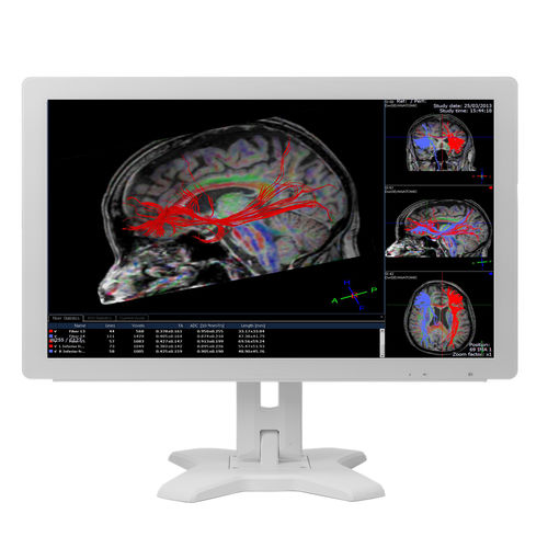 Monitor médico - MMS-21CAHST  - BriteMED Technology - para exames de imagem / para simulação médica / Full HD
