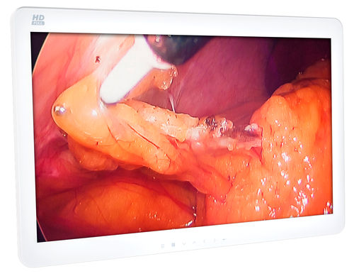 Monitor médico-hospitalar - MEGABYTE Systemhaus GmbH - cirúrgico / Full HD / com resolução 4K