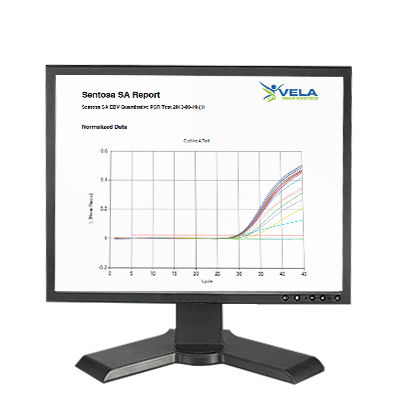 Software de análise - Sentosa SA - Vela Diagnostics - de interpretação / para biologia molecular