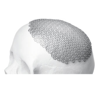 Prótese craniana - BioMesh®  - Bioplate