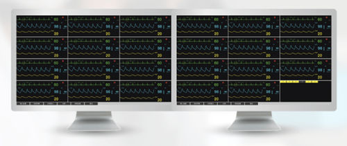 Central de monitoramento paciente - WCMS-88 - Wisonic - 64 camas