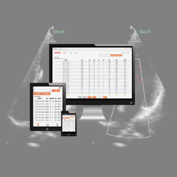 Software de gravação - wiCloud - Wisonic - médico-hospitalar / para ecografia / Windows
