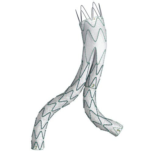 Stent-enxerto de aorta abdominal - LINUS® - Braile Biomedica - em nitinol