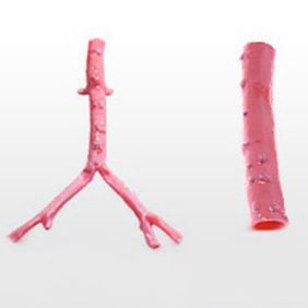 Bioprótese vascular de artéria ilíaca - CryoArtery® - Cryolife - aloenxerto / bifurcada