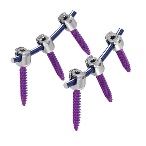 Sistema de osteossíntese toracolombar - MAS® - NuVasive - via posterior