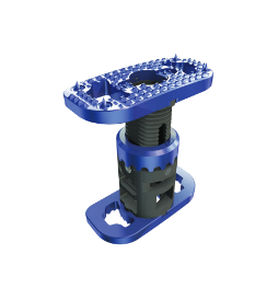Prótese vertebral lombar - XLIF® Corpectomy - NuVasive - extensível