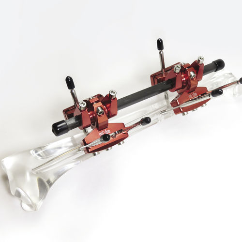 Fixador externo tubular - FIXUS66T - Fixus - infantil