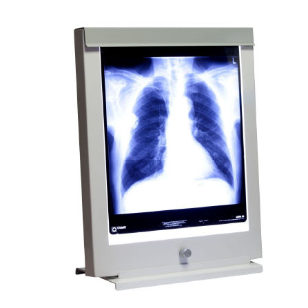 Negatoscópio 1 corpo - Rego X-ray - 2 corpos / 3 corpos / 4 corpos