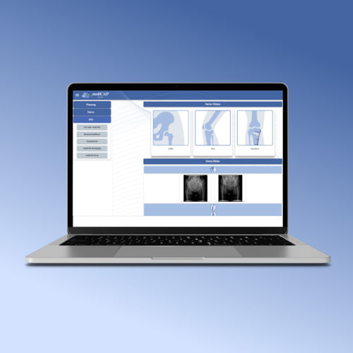 Software de gestão - medc-web-70 series - mediCAD Hectec GmbH - de planejamento / de planejamento pré-operatório / para ortopedia