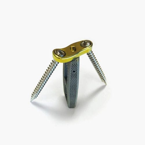 Espaçador intervertebral lombar - Idys®-LLIF 3DTi - Clariance - via lateral / em titânio / com placa óssea lombar