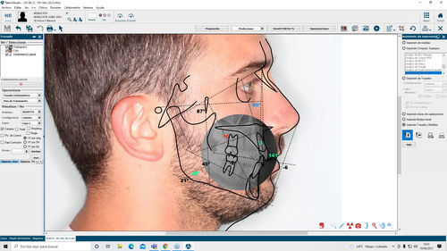 Software de diagnóstico - NemoCeph  - Nemotec - de análise de imagens / de captura / de análise cefalométrica